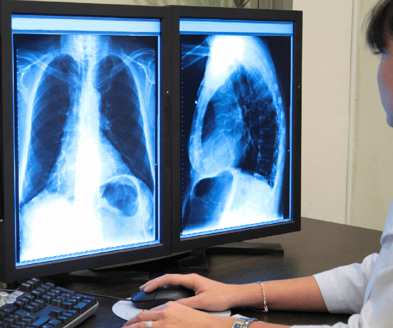 Radiologia Digital